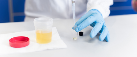 Screening vs. Confirmation Testing: The Business Guide to Workplace Drug Testing