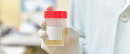 How drug test kits work and the options available in Australia - Andatech