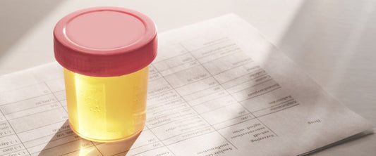 What affects the accuracy of drug test kits