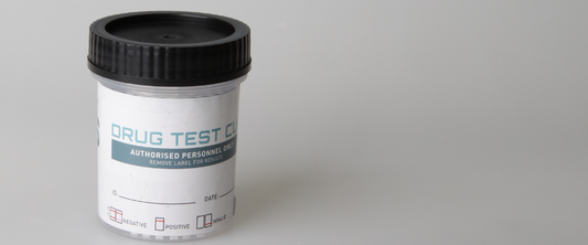 What can a urine drug test kit detect?